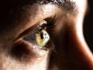 Ceratocone Tem Cura Saiba o Tratamento em Curitiba